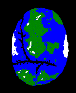 Saving Humpty Dumpty